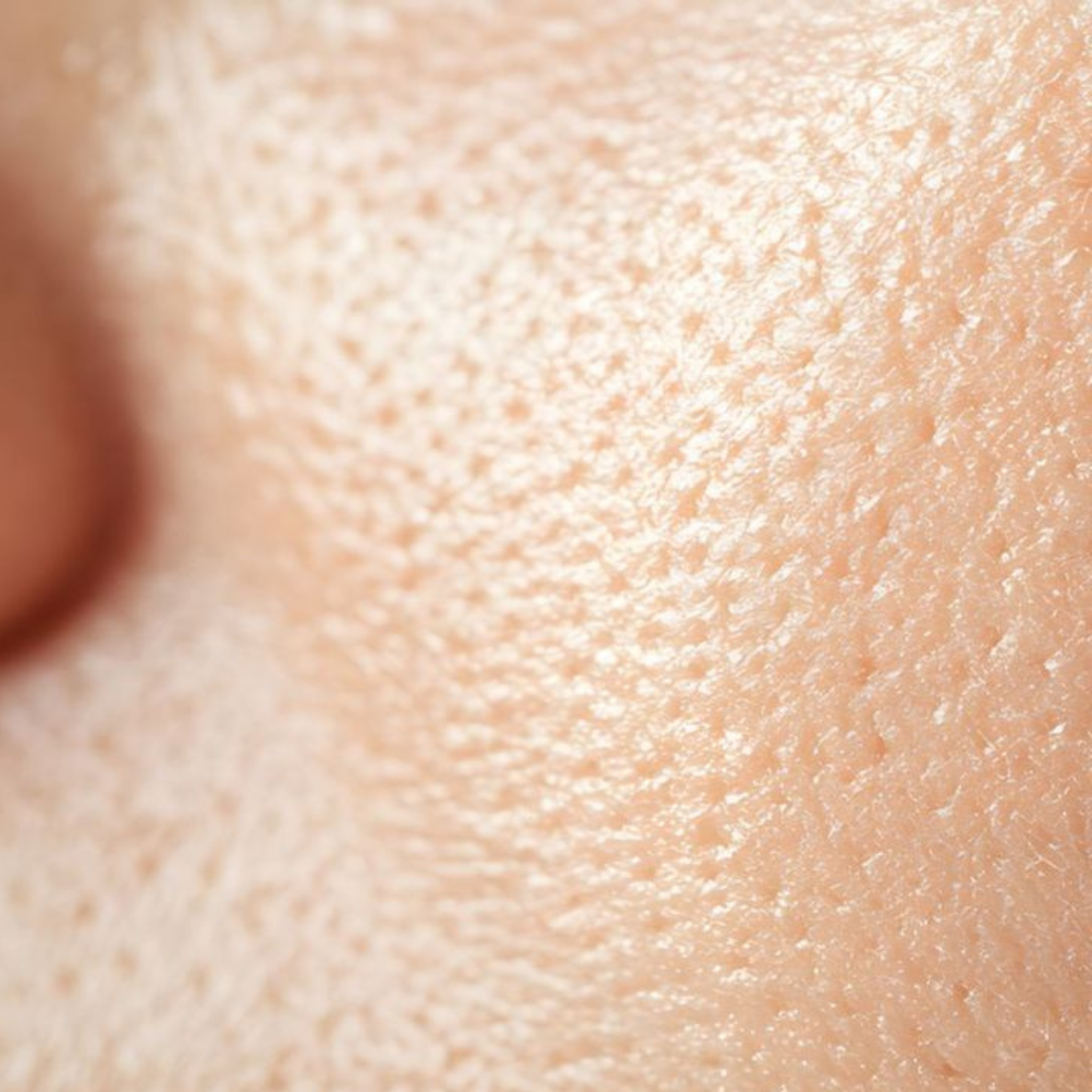 OPEN PORES